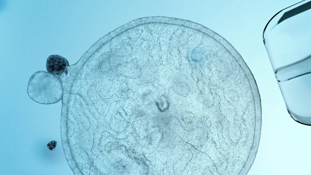 Potencjał terapeutyczny mezenchmalnych komórek macierzystych testowany w&nbsp;próbach klinicznych oraz&nbsp;in&nbsp;vitro – uzasadnienie dla bankowania scharakteryzowanych komórek